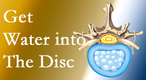 Arctic Chiropractic, Sitka uses spinal manipulation and exercise to boost the diffusion of water into the disc which supports the health of the disc.