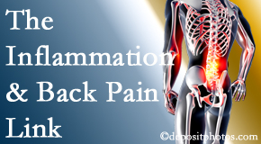 Arctic Chiropractic, Sitka tackles the inflammatory process that accompanies back pain as well as the pain itself.