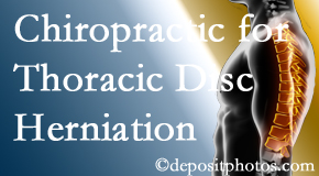 Arctic Chiropractic, Sitka diagnoses and manages thoracic disc herniation pain and relieves its symptoms like unexplained abdominal pain or other gastrointestinal issues. 