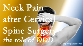 Arctic Chiropractic, Sitka offers gentle care for neck pain after neck surgery.