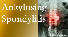 Ankylosing spondylitis is gently cared for by your Sitka chiropractor.