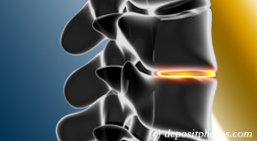 Sitka degenerative spinal changes 