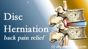 Arctic Chiropractic, Sitka offers non-surgical treatment for relief of disc herniation related back pain. 