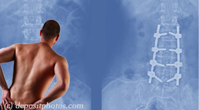 Sitka chiropractic relief for back pain after back surgery