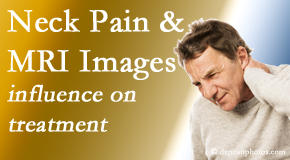 Arctic Chiropractic, Sitka considers MRI findings like Modic Changes when setting up a neck pain relieving treatment plan.
