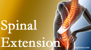 Arctic Chiropractic, Sitka knows the role of extension in spinal motion, its necessity, its benefits and potential harmful effects. 