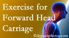 Sitka chiropractic treatment of forward head carriage is two-fold: manipulation and exercise.