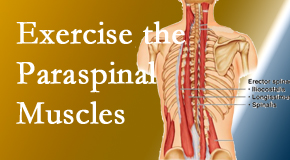 Arctic Chiropractic, Sitka explains the importance of paraspinal muscles and their strength for Sitka back pain relief.