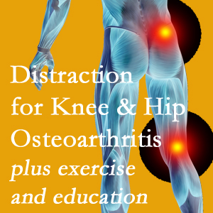 A chiropractic treatment plan for Sitka knee pain and hip pain due to osteoarthritis: education, exercise, distraction.