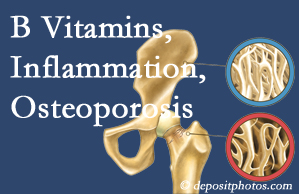 Sitka chiropractic care of osteoporosis usually comes with nutritional tips like b vitamins for inflammation reduction and for prevention.