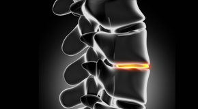 Sitka chiropractic nutrition with vitamin D and quercitrin