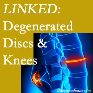 Degenerated discs and degenerated knees are not such unlikely companions. They are seen to be related. Sitka patients with a loss of disc height due to disc degeneration often also have knee pain related to degeneration.  