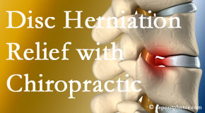 Arctic Chiropractic, Sitka gently treats the disc herniation causing back pain. 